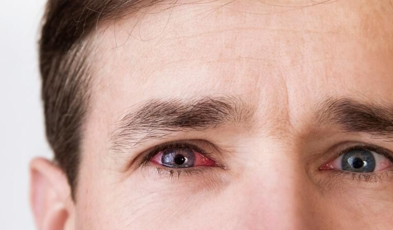 Dia Nacional de Combate ao Glaucoma