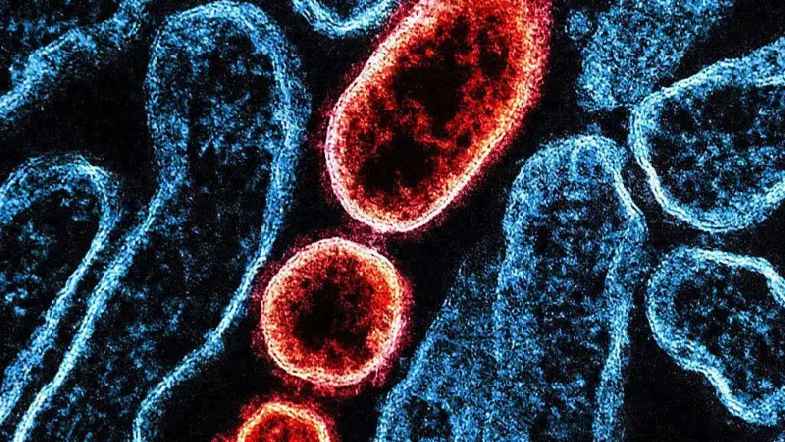 O vírus Nipah no Brasil e o Carnaval 